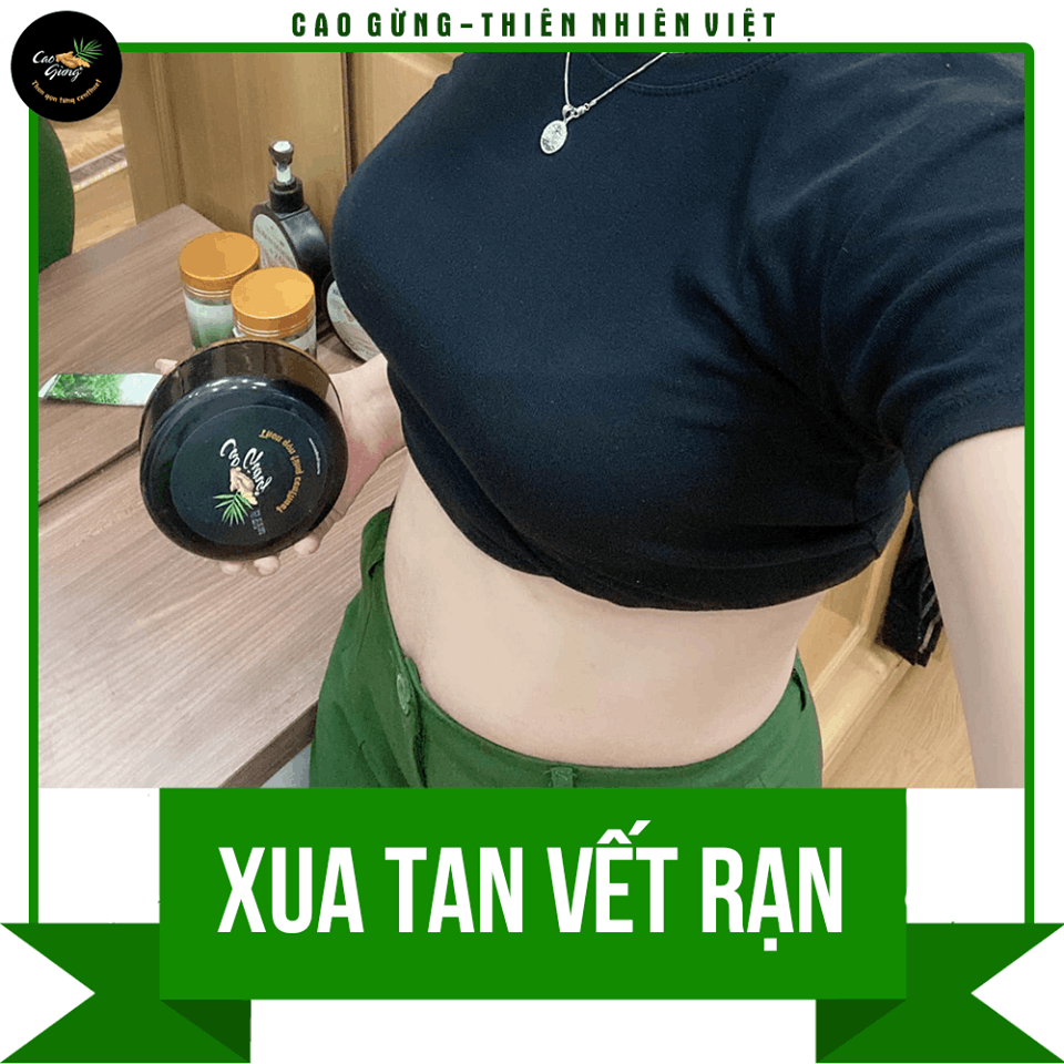 14329-cg165-4-8.png Cao Gừng Tan Mỡ Bụng Thiên Nhiên Việt 250g Phiên Bản 2025 - Tặng Cao Gừng Nghệ Đỏ - 8936079033002