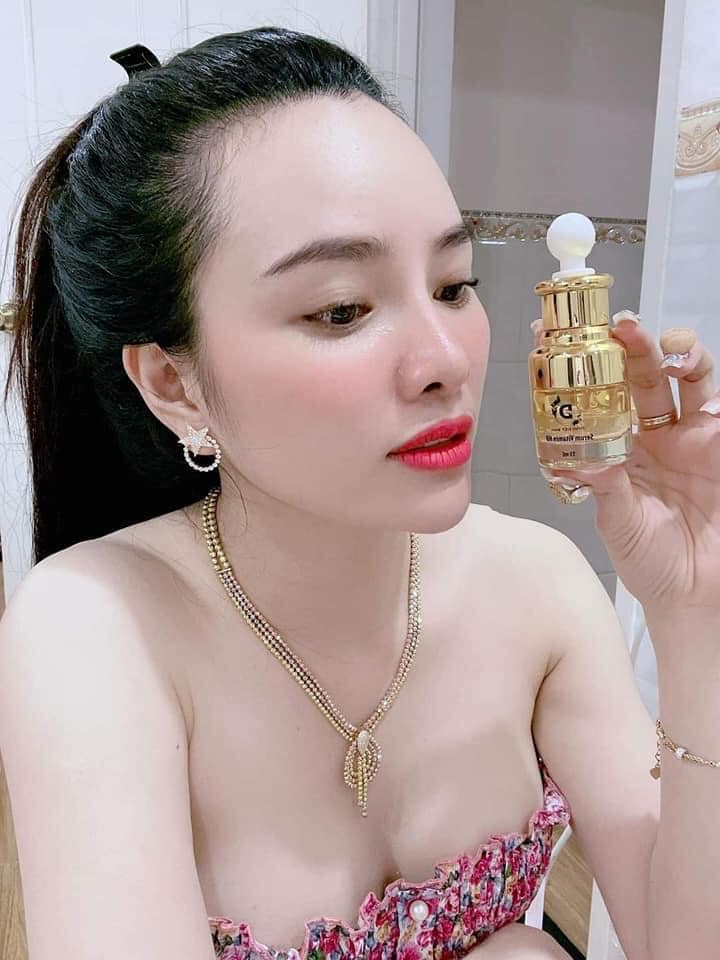 Serum vitamin HD