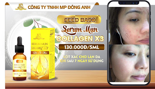 Serum mụn Collagen X3 chính hãng Mỹ Phẩm Đông Anh