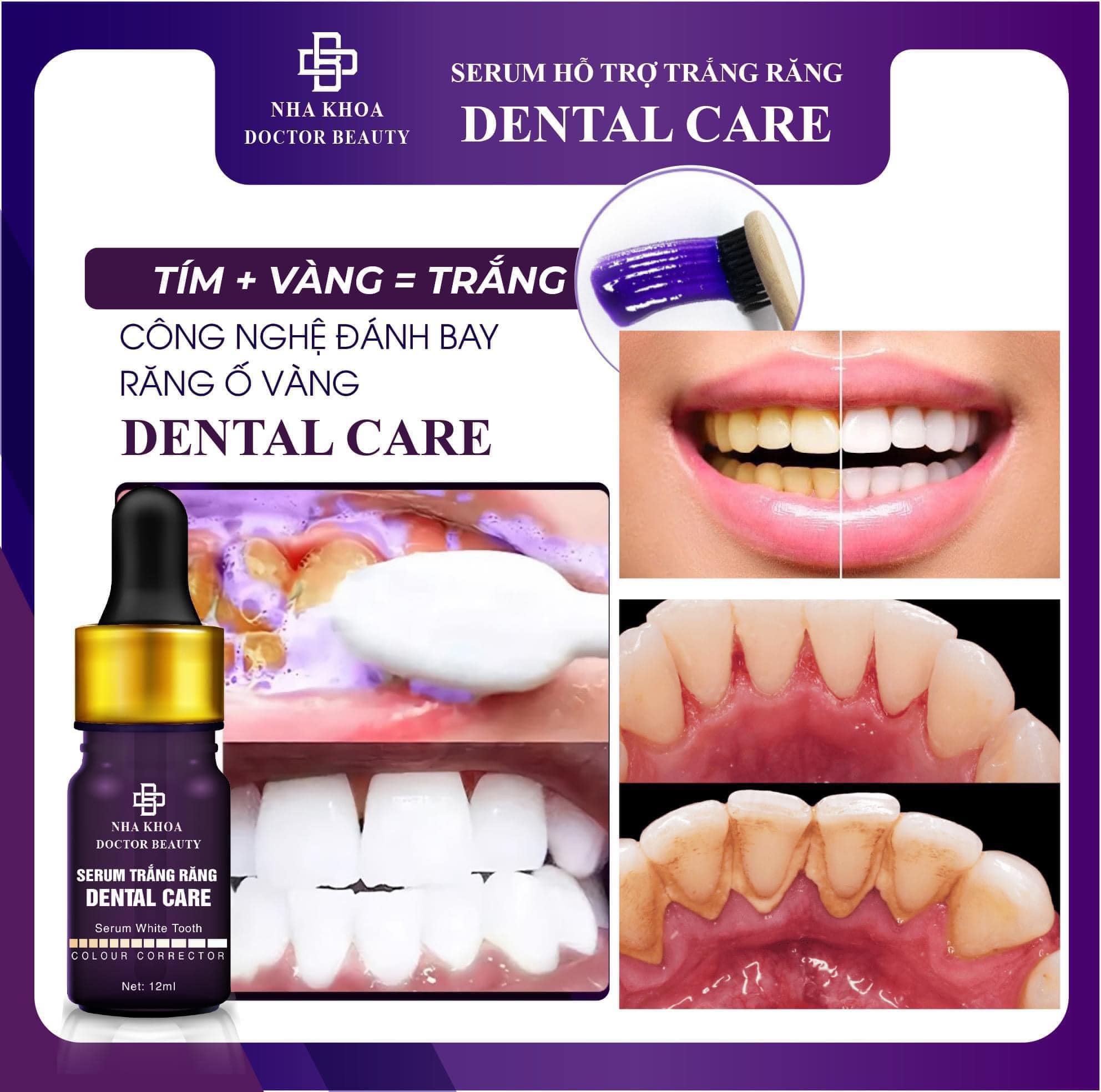 Combo 2 Chai Serum Dental Care Hỗ Trợ Trắng Răng 6 Combo 2 Chai Serum Dental Care Hỗ Trợ Trắng Răng