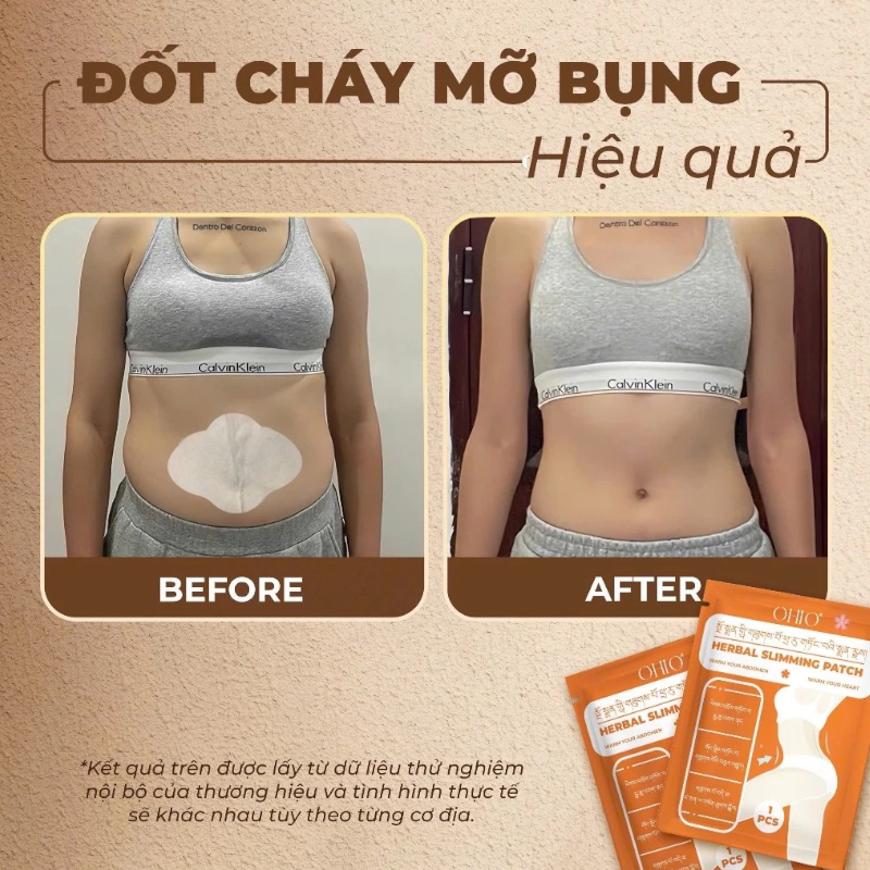 Chuyên sỉ miếng Dán Tan Mỡ Đông Y Tây Tạng Ohio Slimming Patch 8 Chuyên sỉ miếng Dán Tan Mỡ Đông Y Tây Tạng Ohio Slimming Patch