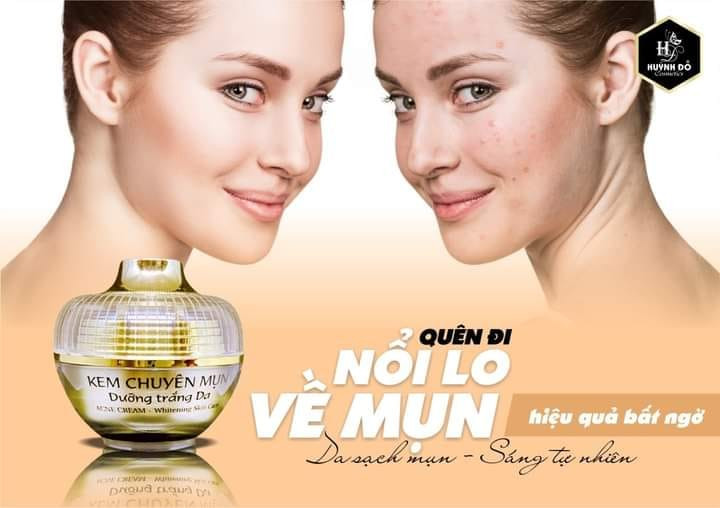 Kem Face Chuyên Nám Huỳnh Đỗ Melasma Cream