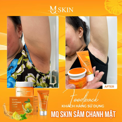 Combo Kem Tẩy Lông + Kem Thâm Nách MQ Skin Sâm Chanh Mật chính hãng