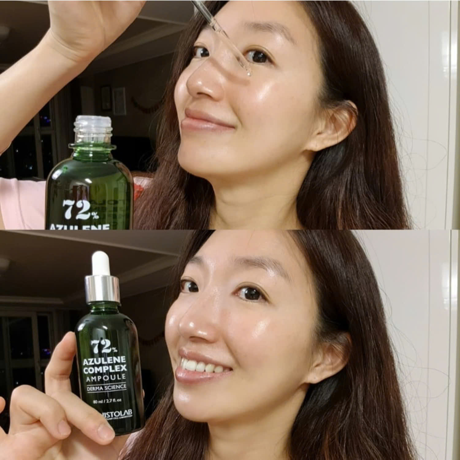 Vẫn đang lăn tăn lựa chọn serum dưỡng cho da mụn hẻ  Chọn liền Tinh Chất Histolab 72% Azulene Complex Ampoule đi thôi.
