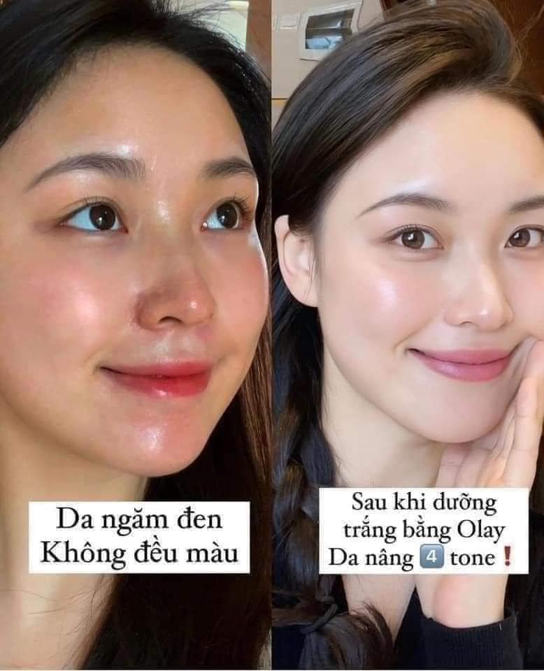 Kem Dưỡng OLAY Total Effects 7 in 1 Day Moisturiser Nourish & Protect SPF15 là sản phẩm có hỗ trợ cả chống nắng