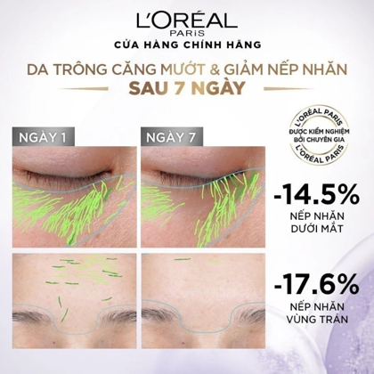 6358 25811 serum loreal tim phu photoroom 6 20241123114515 20241125160146