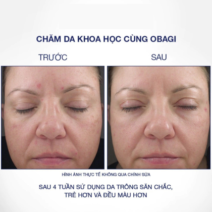 Kem Dưỡng Obagi Retinol 1.0% Trẻ Hóa Da mê đắm thật sự em này của Obagi này