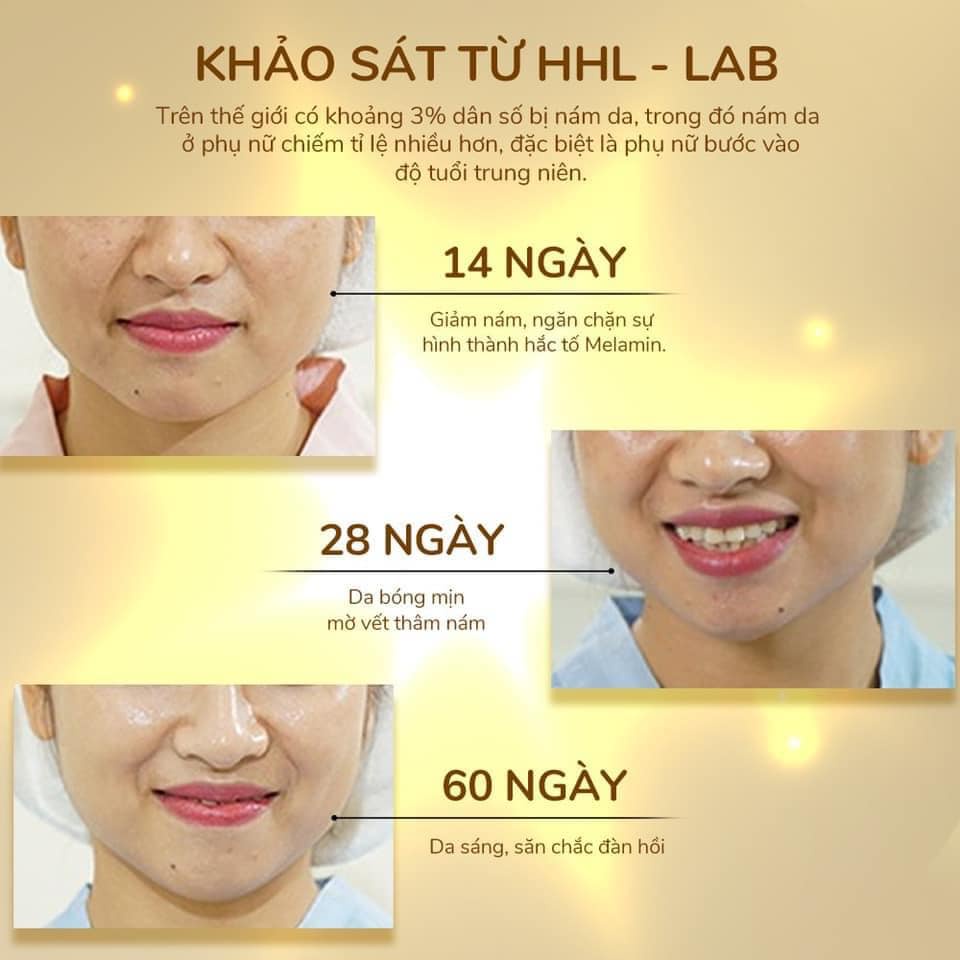 Tái Sinh Làn Da Tổn Thương Với Kem Dưỡng Huyết Yến Phục Hồi KB One