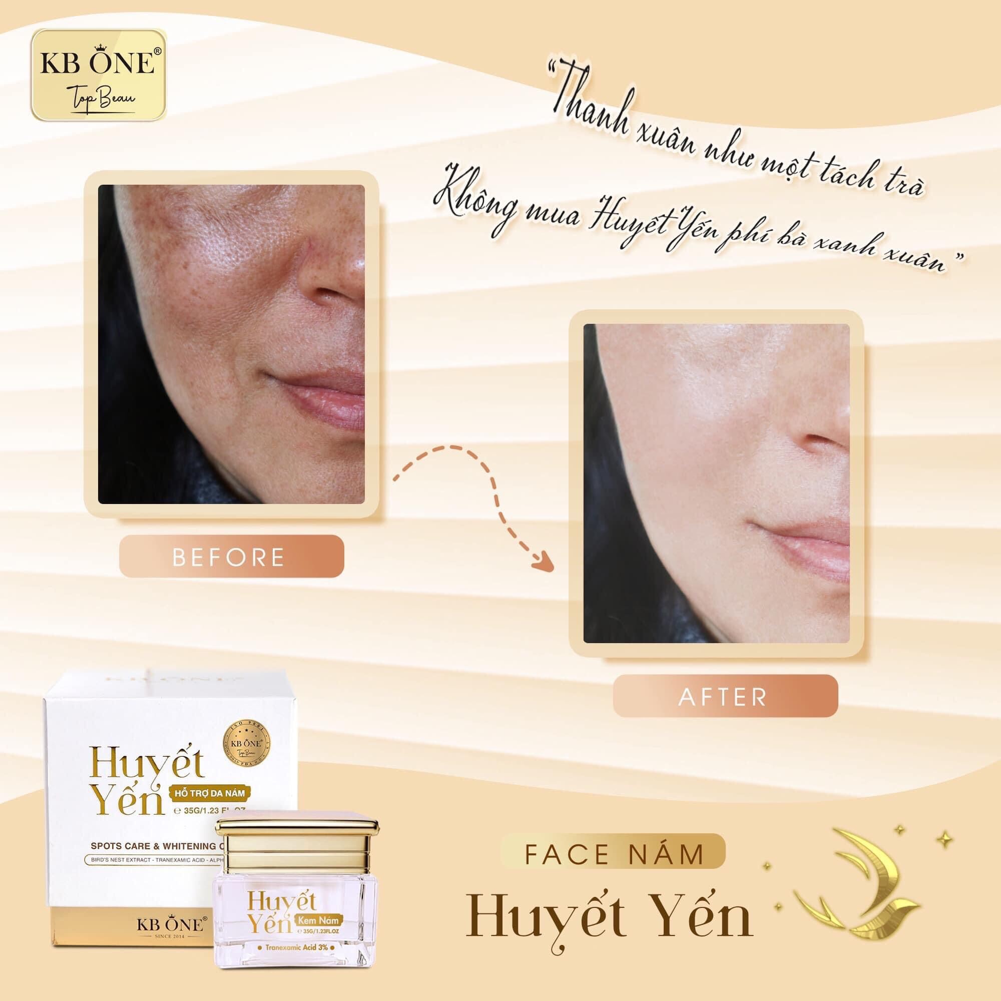 Nâng Niu Và Chăm Sóc Da Với Kem Dưỡng Huyết Yến Phục Hồi KB One 12 Nâng Niu Và Chăm Sóc Da Với Kem Dưỡng Huyết Yến Phục Hồi KB One
