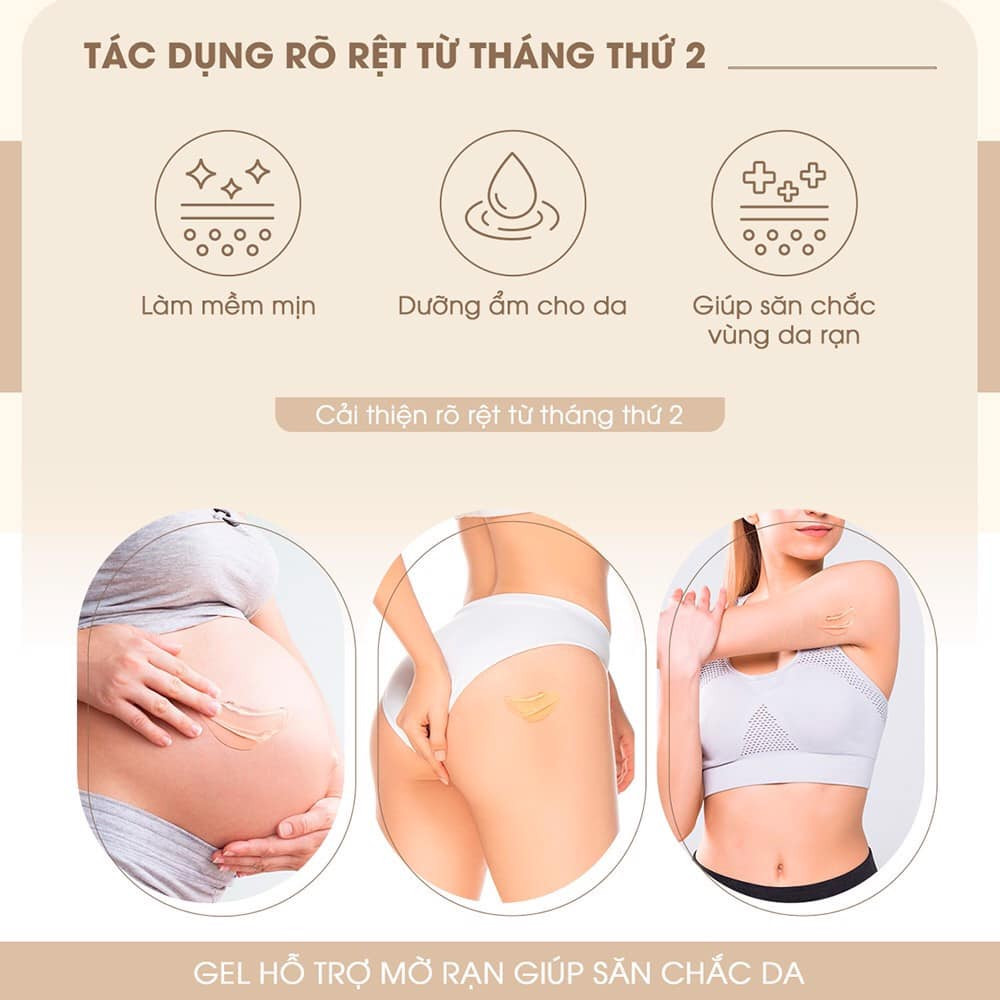 Rạn da trong thai kì không còn là nỗi lo